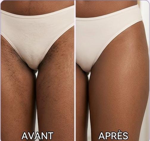 Yasmine K. comparison